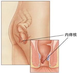 福州医博肛泰肛肠医院预约挂号